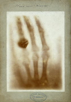 Primeira radiografia da História